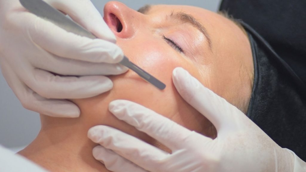 Microplaning Tooth New Treatment: Dermaplaning, the ultimate exfoliation! – Beauty on Latrobe